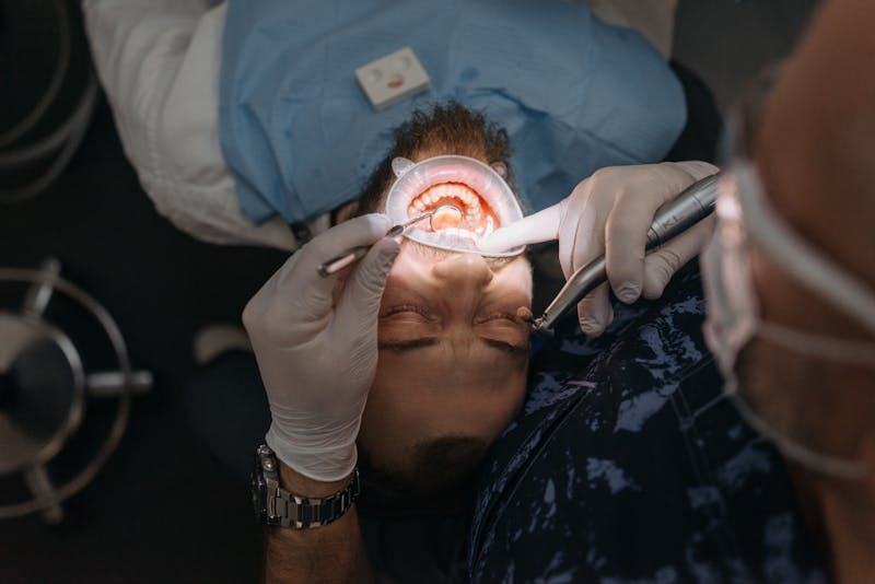 Man receiving a dental examination for teeth grinding assessment