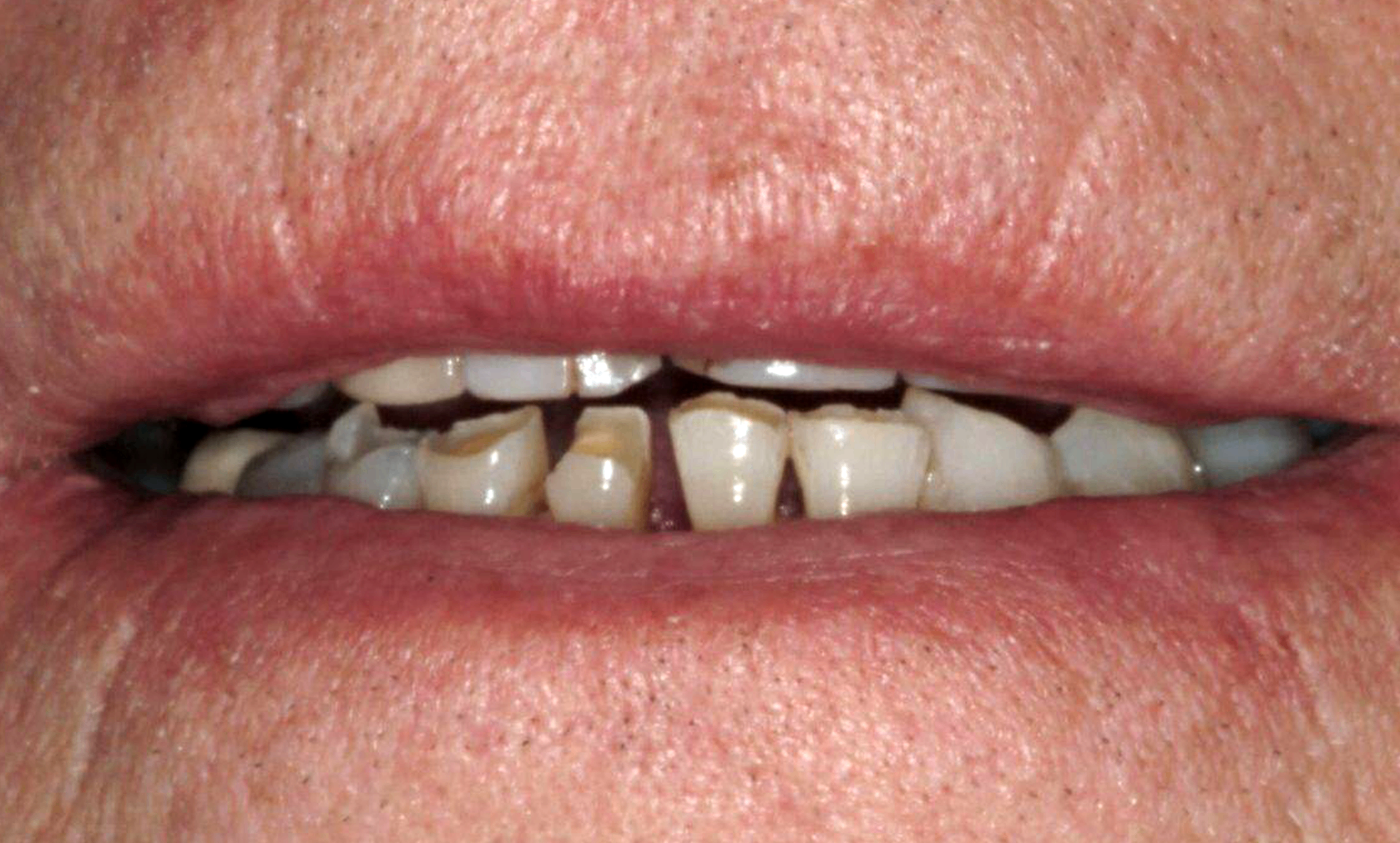 Before treatment