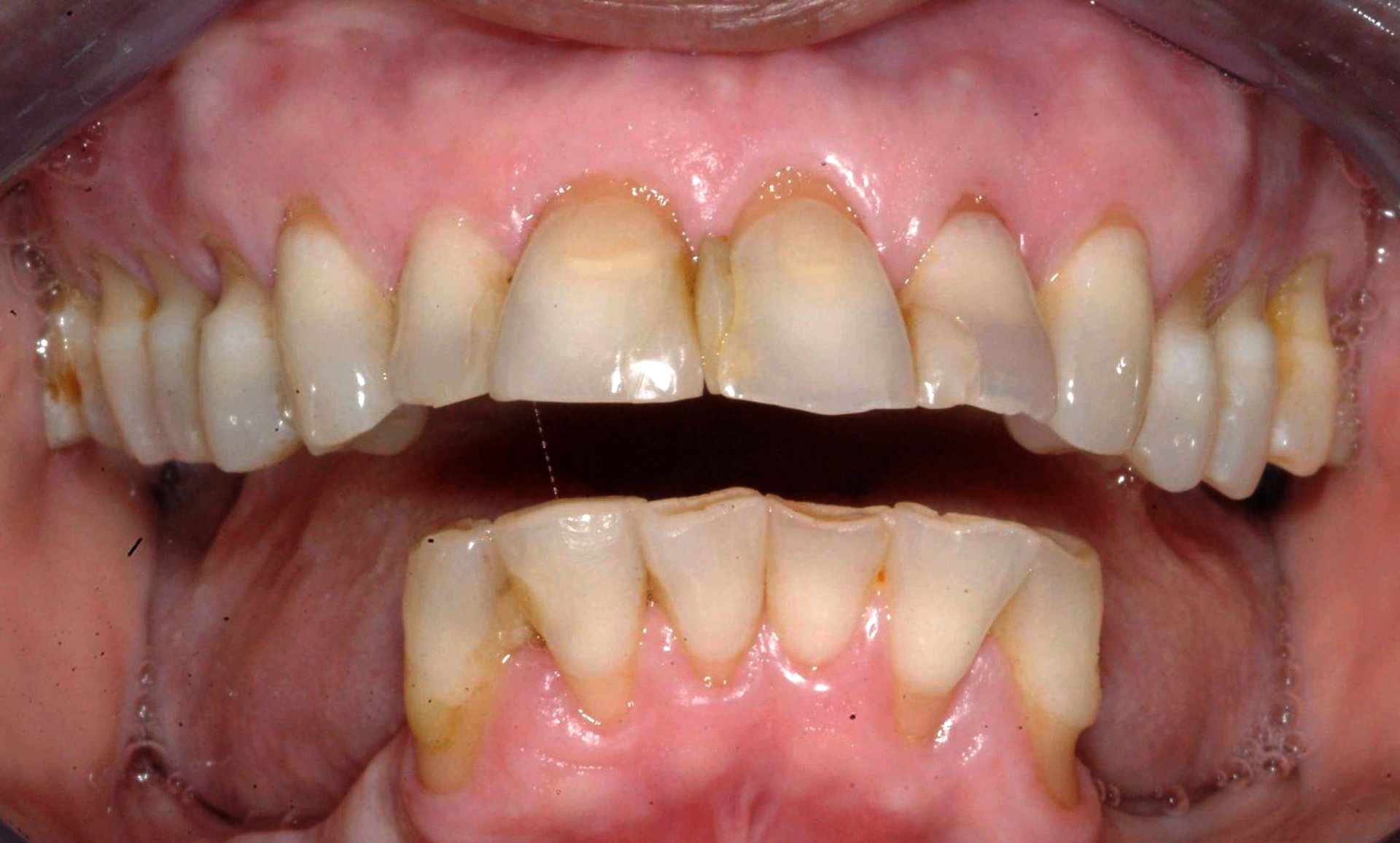 Before treatment